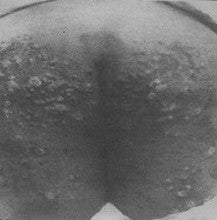 Guilty Connector : Colesterinosis Extracelular (CDr, Mini, Ltd, Num)
